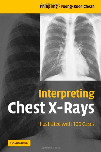 Stock image for Interpreting Chest X-Rays : Illustrated with 100 Cases for sale by Better World Books