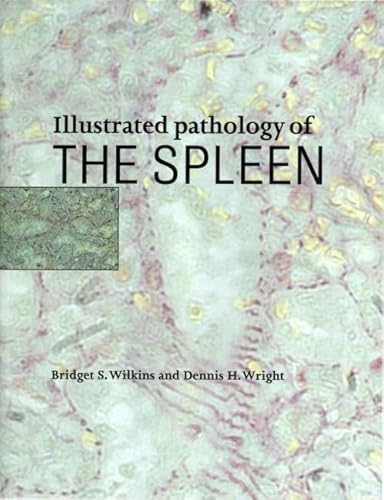 Beispielbild fr Illustrated Pathology of the Spleen zum Verkauf von Ammareal