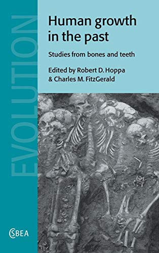 Human Growth in the Past - Studies from Bones and Teeth