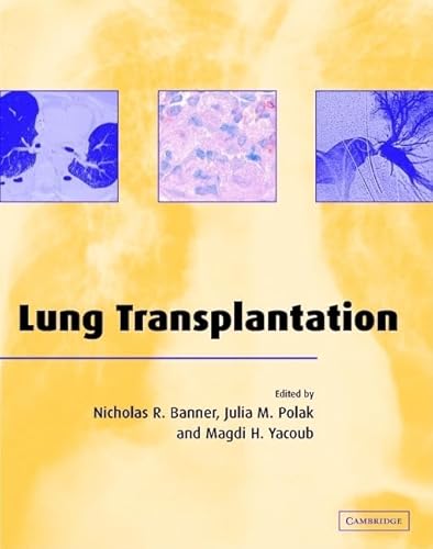 Stock image for Lung Transplantation (Postgraduate Medical Science) for sale by medimops