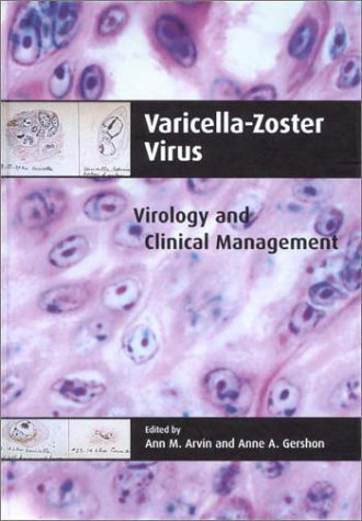 Beispielbild fr Varicella-zoster Virus: Virology And Clinical Management zum Verkauf von Basi6 International