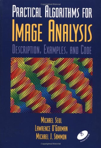 Practical Algorithms for Image Analysis: Description, Examples, and Code