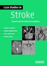 Imagen de archivo de Case Studies in Stroke: Common and Uncommon Presentations (Case Studies in Neurology) a la venta por Goodwill Books