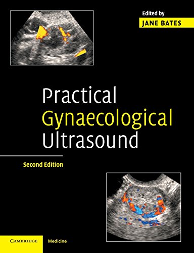 9780521674508: Practical Gynaecological Ultrasound