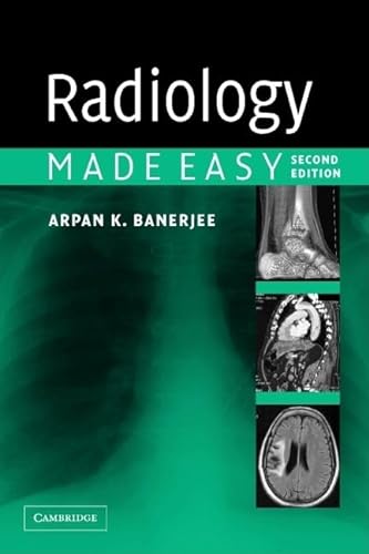 9780521676359: Radiology Made Easy, Second Edition