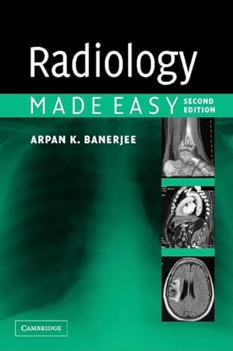 9780521676359: Radiology Made Easy