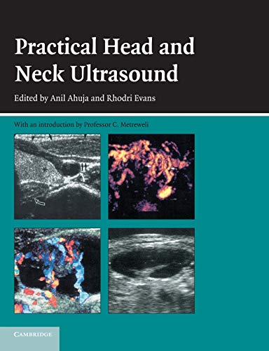 Beispielbild fr Practical Head and Neck Ultrasound zum Verkauf von WorldofBooks