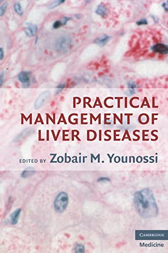 Practical Management of Liver Diseases
