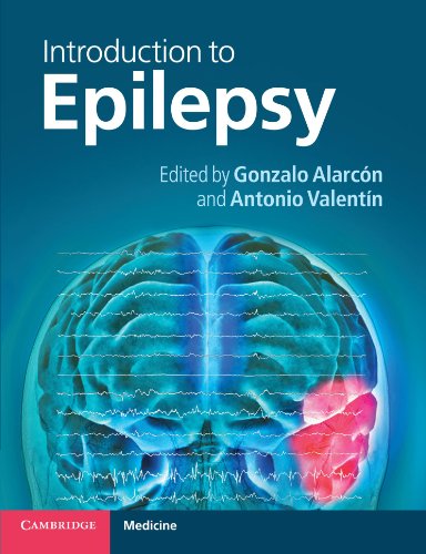 Beispielbild fr Introduction to Epilepsy zum Verkauf von Blackwell's