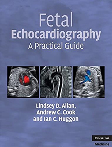 9780521695206: Fetal Echocardiography: A Practical Guide