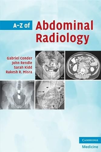 Stock image for A-Z of Abdominal Radiology for sale by Better World Books Ltd