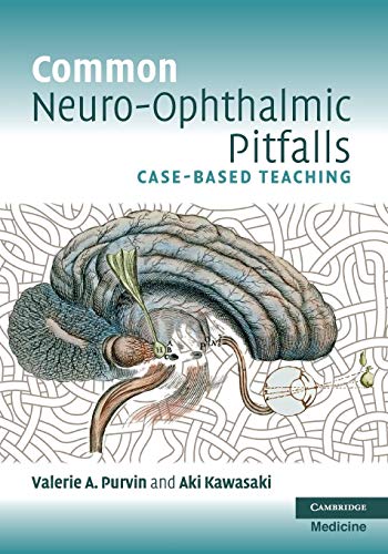 Imagen de archivo de Common Neuro-Ophthalmic Pitfalls: Case-based Teaching (Cambridge Medicine (Paperback)) a la venta por Chiron Media