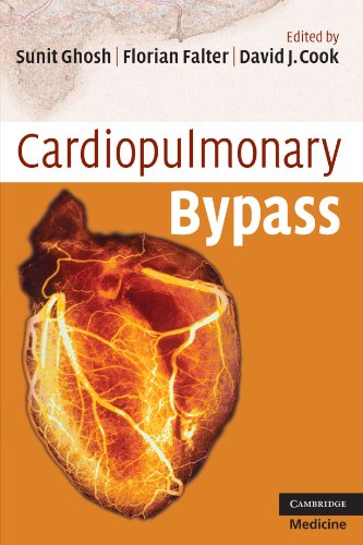 Stock image for Cardiopulmonary Bypass for sale by Better World Books