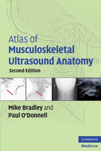 Atlas of Musculoskeletal Ultrasound Anatomy (9780521728096) by Bradley, Mike; O'Donnell, Paul