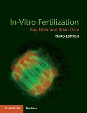 Stock image for In-Vitro Fertilization for sale by Better World Books