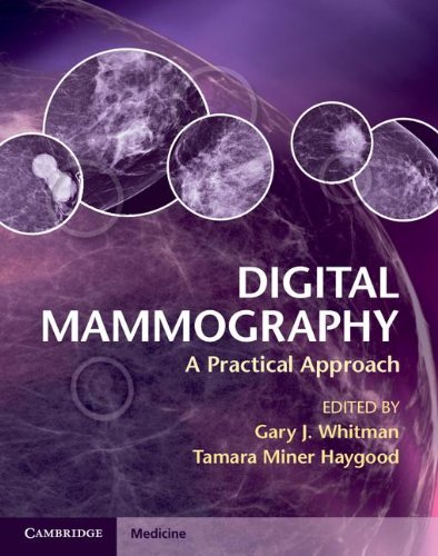 Imagen de archivo de Digital Mammography: A Practical Approach a la venta por AwesomeBooks