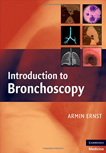 Stock image for Introduction to Bronchoscopy for sale by Labyrinth Books