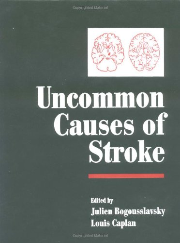 Beispielbild fr Uncommon Causes of Stroke zum Verkauf von Anybook.com