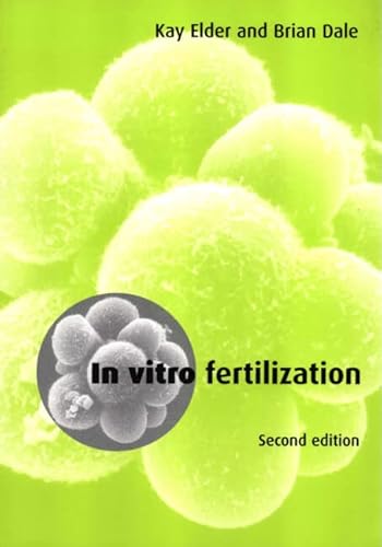 Beispielbild fr In-Vitro Fertilization zum Verkauf von Better World Books