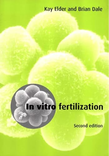 Stock image for In-Vitro Fertilization for sale by Better World Books: West