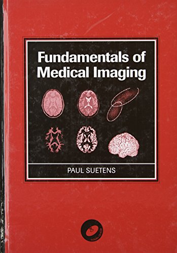 Beispielbild fr Fundamentals of Medical Imaging [With CDROM] zum Verkauf von ThriftBooks-Atlanta