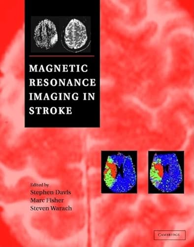 Beispielbild fr Magnetic Resonance Imaging in Stroke Edited zum Verkauf von online-buch-de