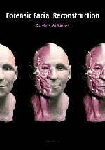 9780521820035: Forensic Facial Reconstruction