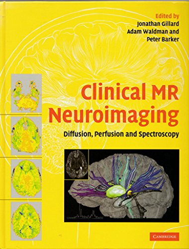 Imagen de archivo de Clinical MR Neuroimaging: Diffusion, Perfusion and Spectroscopy a la venta por HPB-Red