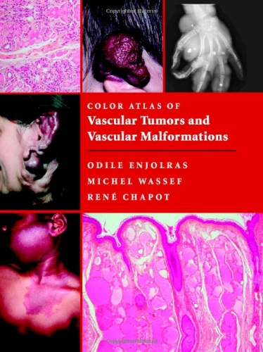 9780521848510: Color Atlas of Vascular Tumors and Vascular Malformations Hardback
