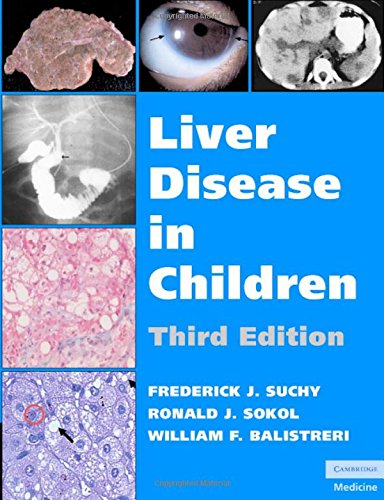Stock image for Liver Disease in Children for sale by The Green Arcade