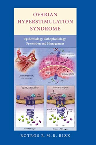 Stock image for Ovarian Hyperstimulation Syndrome: Epidemiology, Pathophysiology, Prevention and Management for sale by AwesomeBooks