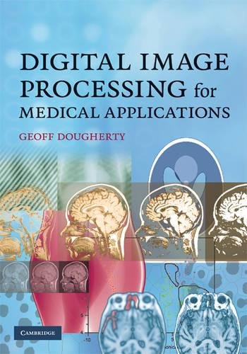 9780521860857: Digital Image Processing for Medical Applications Hardback