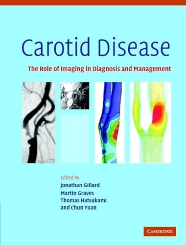 Stock image for Carotid Disease: The Role of Imaging in Diagnosis and Management for sale by HPB-Red