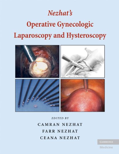 Stock image for Nezhat's Operative Gynecologic Laparoscopy with Hysteroscopy : Principles and Techniques for sale by Better World Books