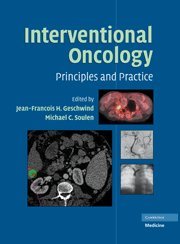 Stock image for Interventional Oncology: Principles and Practice for sale by HPB-Red