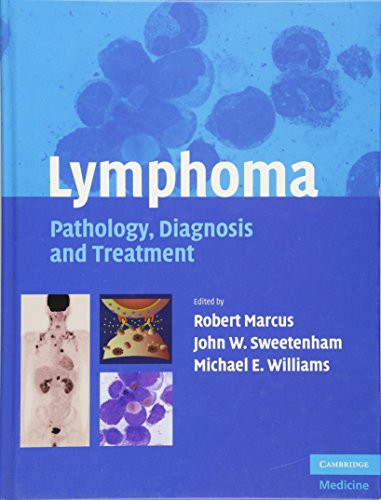 9780521865449: Lymphoma: Pathology, Diagnosis and Treatment