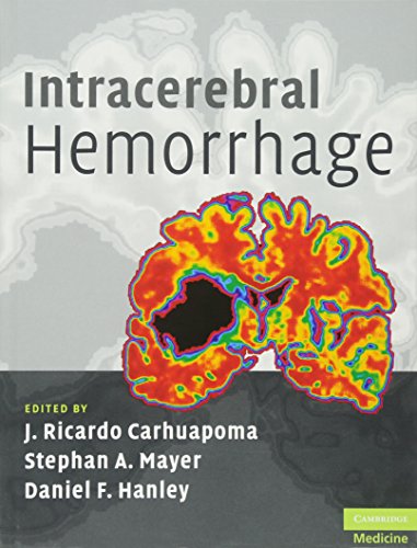 Stock image for Intracerebral Hemorrhage for sale by Blackwell's