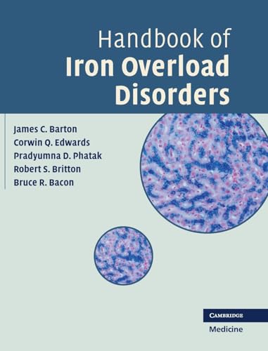 Imagen de archivo de Handbook of Iron Overload Disorders a la venta por Books Puddle