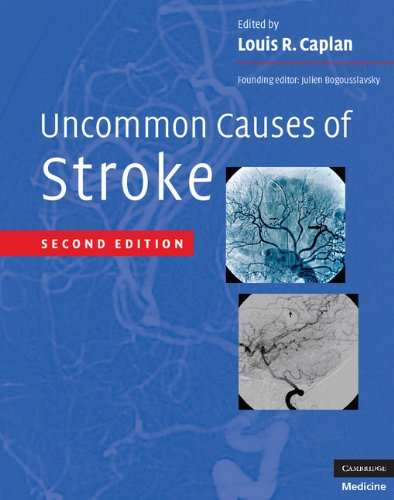 Stock image for Uncommon Causes of Stroke for sale by HPB-Red