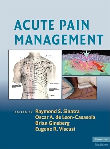 9780521874915: Acute Pain Management Hardback (Cambridge Medicine (Hardcover))