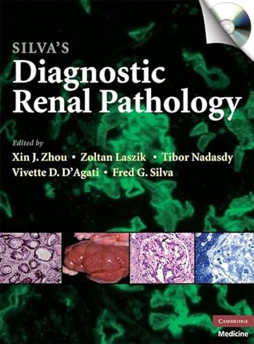 Stock image for Silva's Diagnostic Renal Pathology for sale by Better World Books Ltd