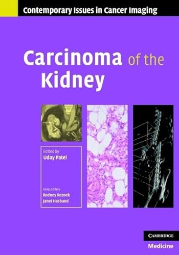 Beispielbild fr Carcinoma of the Kidney zum Verkauf von Better World Books