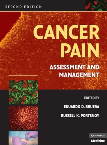 Imagen de archivo de Cancer Pain : Assessment and Management a la venta por Better World Books Ltd