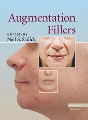 9780521881128: Augmentation Fillers Hardback