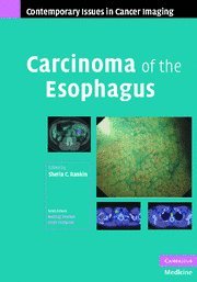 Beispielbild fr Carcinoma of the Esophagus (Contemporary Issues in Cancer Imaging) zum Verkauf von AwesomeBooks