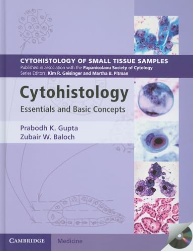 9780521883580: Cytohistology with CD-ROM: Essential and Basic Concepts (Cytohistology of Small Tissue Samples)