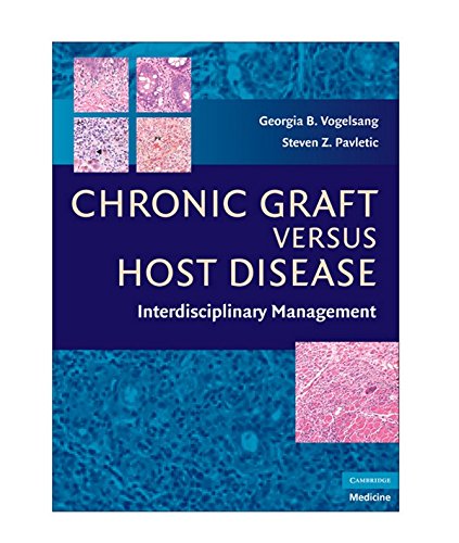 9780521884235: Chronic Graft Versus Host Disease Hardback: Interdisciplinary Management