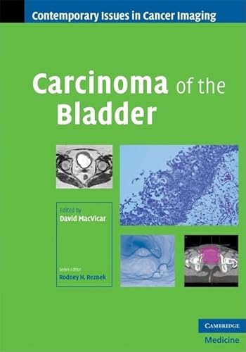 Carcinoma of the Bladder.