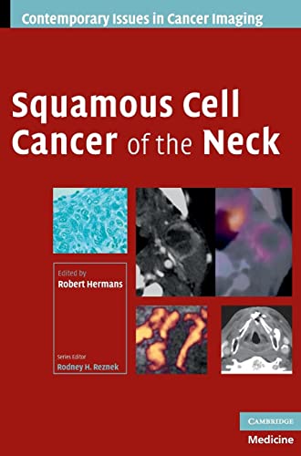 Stock image for Squamous Cell Cancer of the Neck (Contemporary Issues in Cancer Imaging) for sale by AwesomeBooks