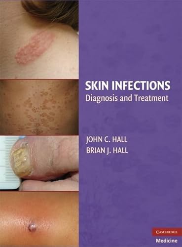 Imagen de archivo de Skin Infections: Diagnosis and Treatment a la venta por BOOKWEST